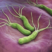 Vi khuẩn Helicobacter Pylori